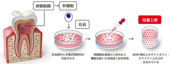 歯髄幹細胞上清液